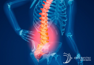 Lee más sobre el artículo Osteoporosis